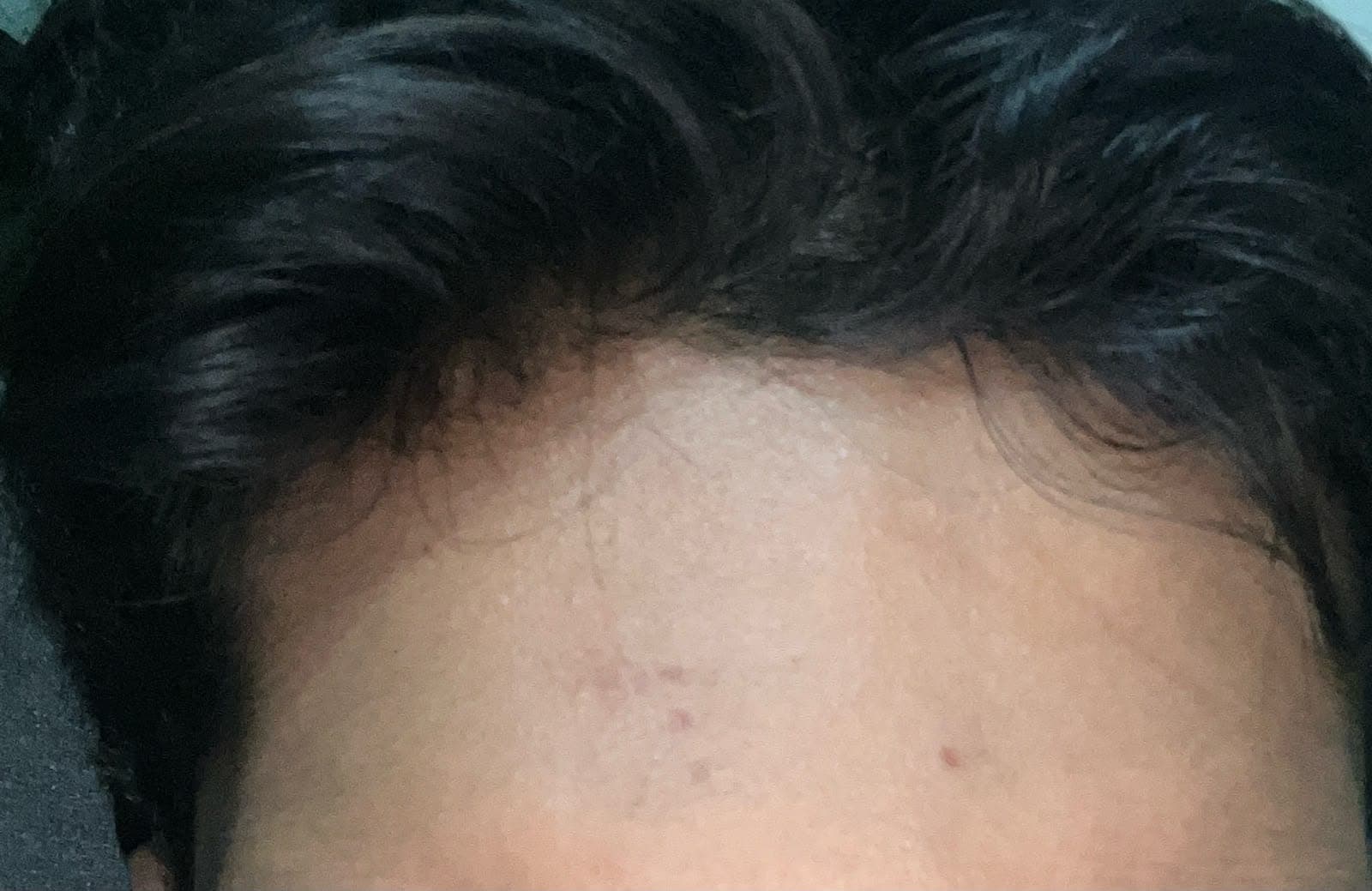 After